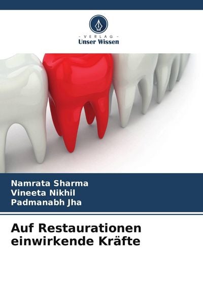 Produktbild: Auf Restaurationen einwirkende Kr&auml;fte