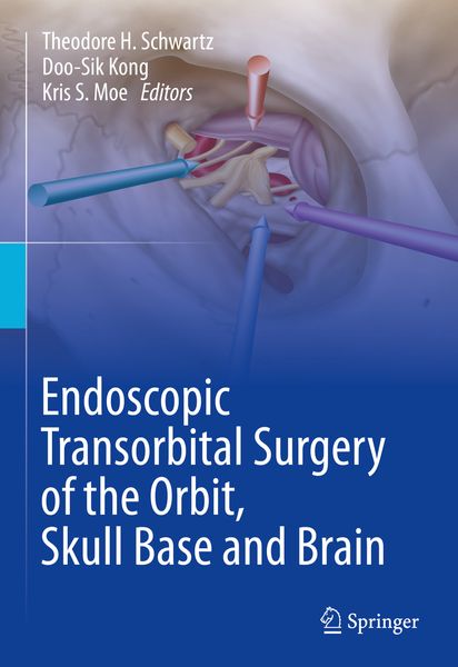 Produktbild: Endoscopic Transorbital Surgery of the Orbit, Skull Base and Brain
