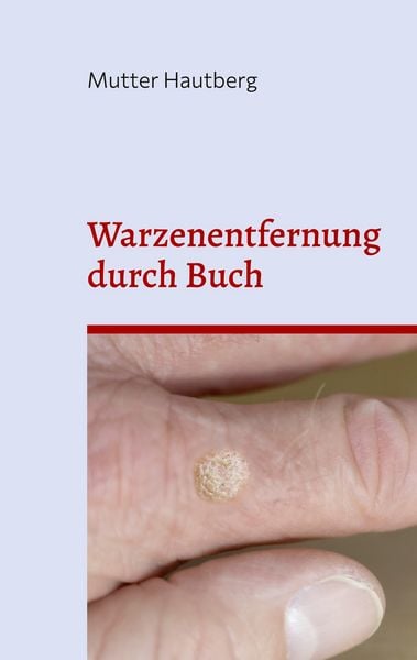 Produktbild: Warzenentfernung durch Buch