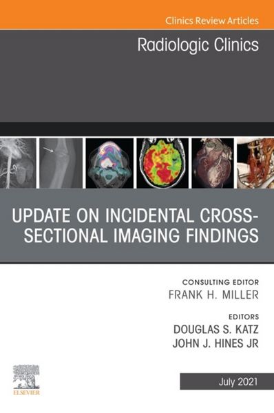 Produktbild: Update on Incidental Cross-sectional Imaging Findings, An Issue of Radiologic Clinics of North America, EBook