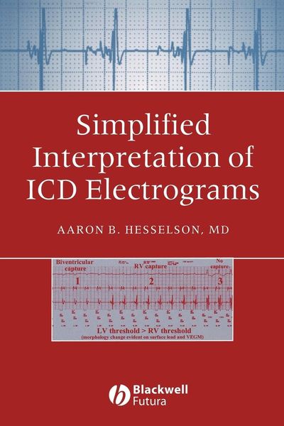 Produktbild: Simplified Interpretation of ICD Electrograms