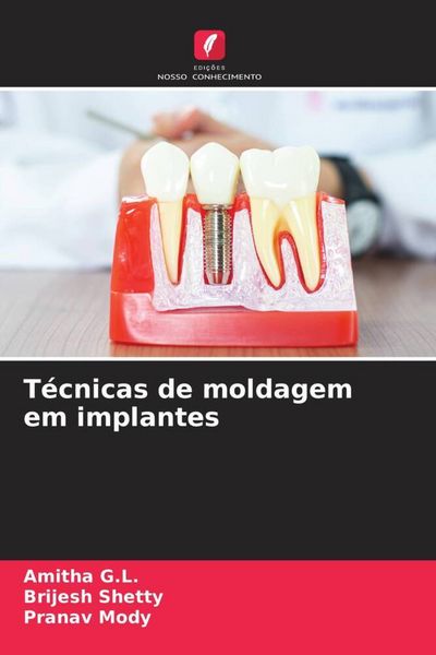Produktbild: T&eacute;cnicas de moldagem em implantes