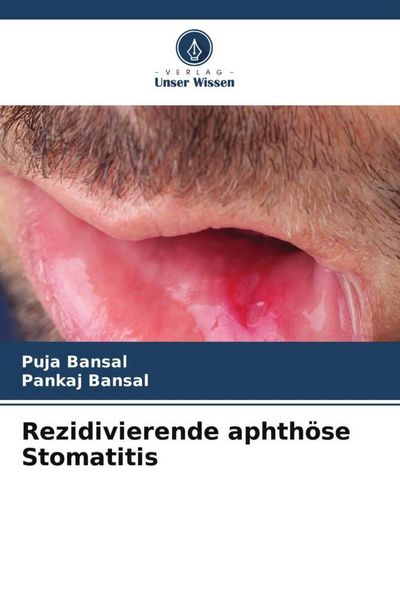 Produktbild: Rezidivierende aphth&ouml;se Stomatitis
