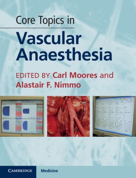 Produktbild: Core Topics in Vascular Anaest
