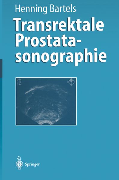 Produktbild: Transrektale Prostatasonographie