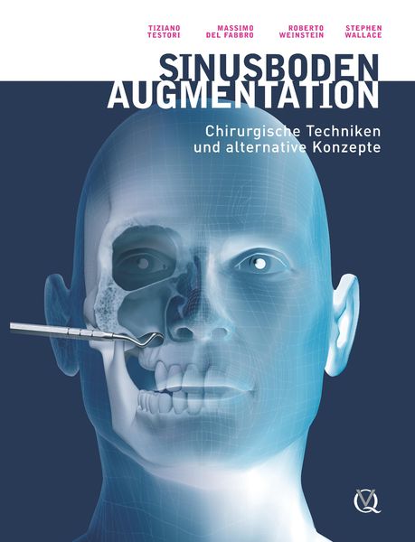 Produktbild: Sinusbodenaugmentation
