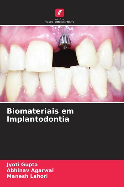 Produktbild: Biomateriais em Implantodontia
