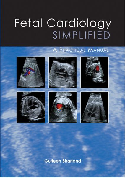 Produktbild: Fetal Cardiology Simplified