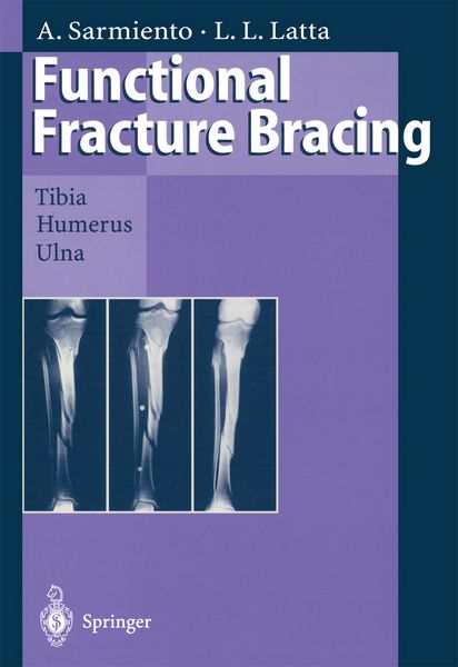 Produktbild: Functional Fracture Bracing