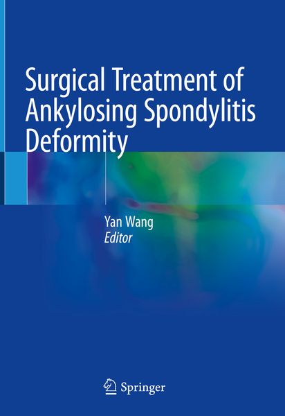 Produktbild: Surgical Treatment of Ankylosing Spondylitis Deformity