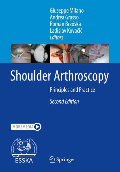 Produktbild: Shoulder Arthroscopy