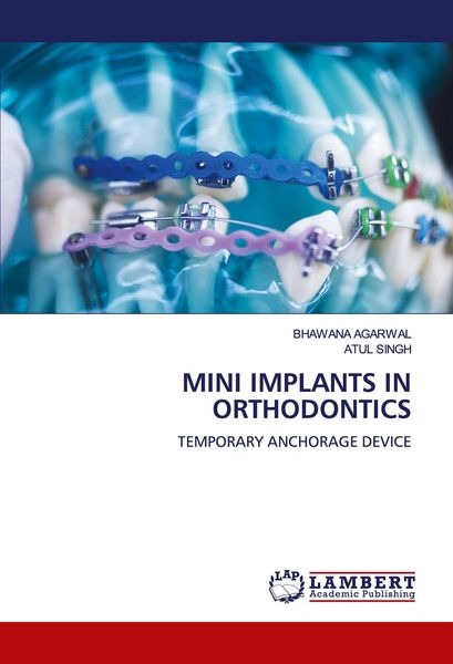 Produktbild: Mini Implants in Orthodontics