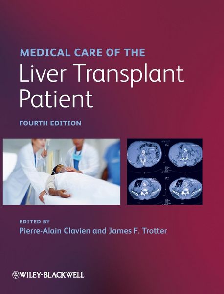 Produktbild: Medical Care of the Liver Transplant Patient