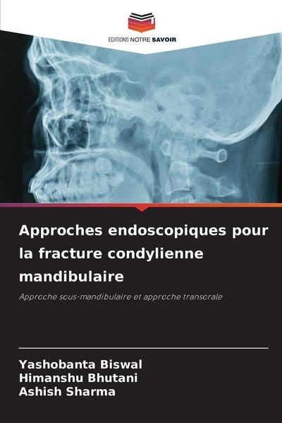 Produktbild: Approches endoscopiques pour la fracture condylienne mandibulaire
