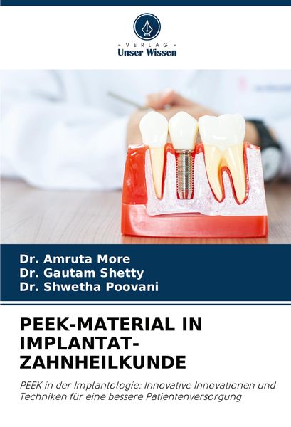 Produktbild: Peek-Material in Implantat-Zahnheilkunde