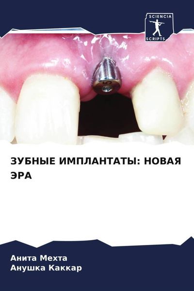 Produktbild: Zubnye Implantaty: Novaya Jera