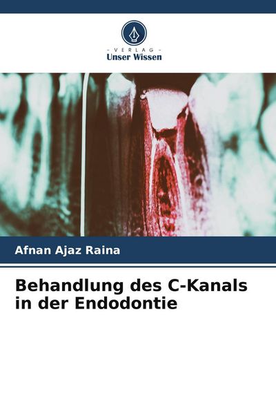 Behandlung des C-Kanals in der Endodontie, Taschenbuch von Afnan Ajaz Raina, Verlag Unser Wissen, 9786205586631