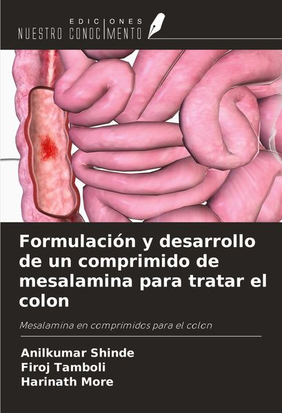 Produktbild: Formulaci&oacute;n y desarrollo de un comprimido de mesalamina para tratar el colon