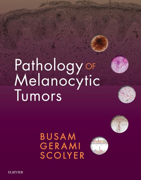 Produktbild: Pathology of Melanocytic Tumors E-Book