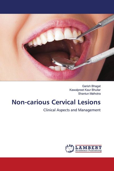 Produktbild: Non-carious Cervical Lesions