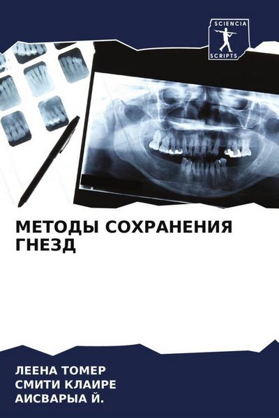 Produktbild: METODY SOHRANENIYa GNEZD