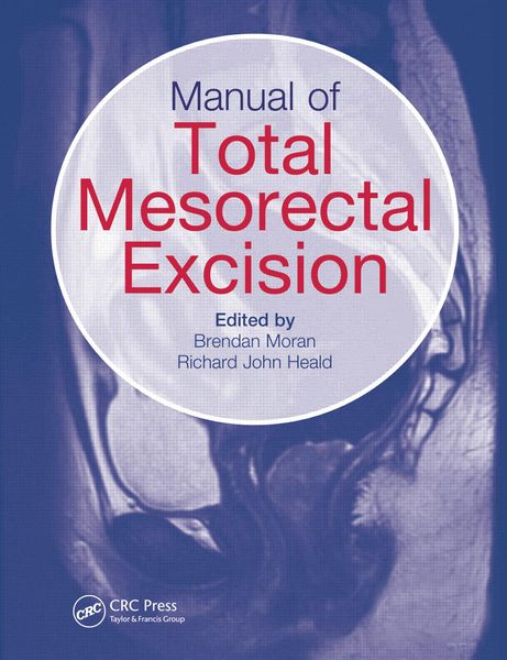Produktbild: Manual of Total Mesorectal Excision