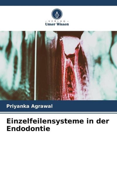 Produktbild: Einzelfeilensysteme in der Endodontie