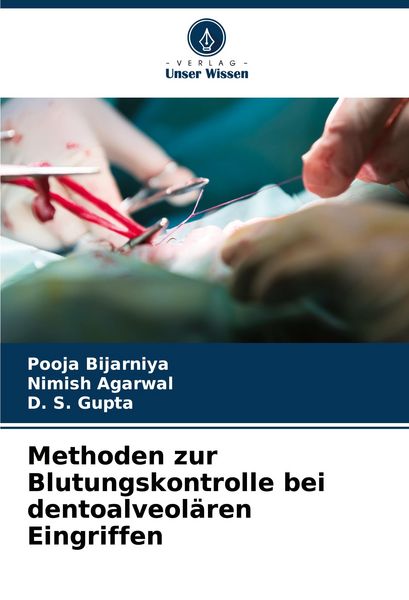Methoden zur Blutungskontrolle bei dentoalveolären Eingriffen, Taschenbuch von Pooja Bijarniya , Nimish Agarwal , D. S. Gupta, Verlag Unser Wissen,