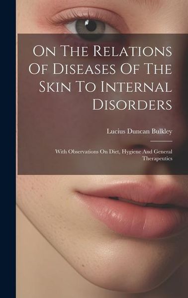Produktbild: On The Relations Of Diseases Of The Skin To Internal Disorders: With Observations On Diet, Hygiene And General Therapeutics