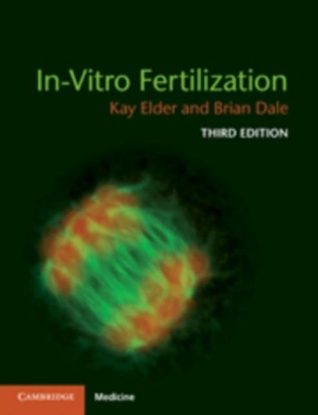 Produktbild: In-Vitro Fertilization