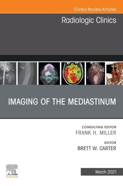 Produktbild: Imaging of the Mediastinum, An Issue of Radiologic Clinics of North America