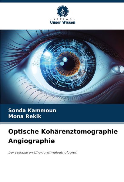 Produktbild: Optische Koh&auml;renztomographie Angiographie