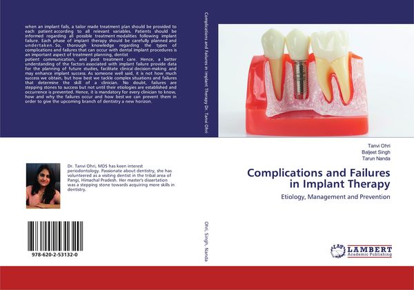 Produktbild: Complications and Failures in Implant Therapy