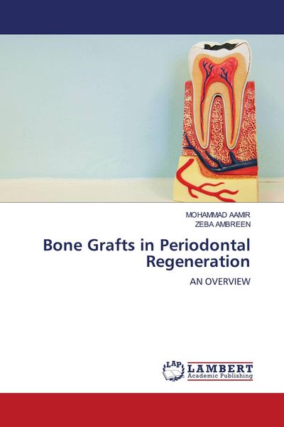Produktbild: Bone Grafts in Periodontal Regeneration
