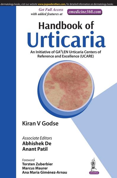 Produktbild: Handbook of Urticaria