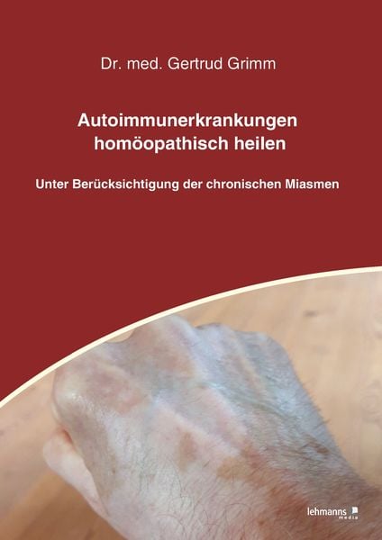 Produktbild: Autoimmunerkrankungen hom&ouml;opathisch heilen