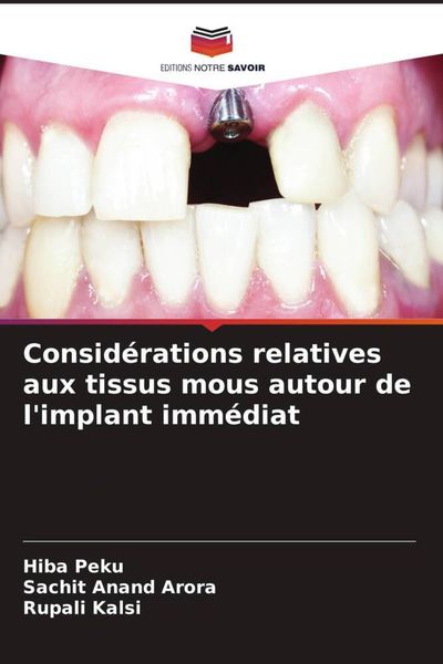 Produktbild: Consid&eacute;rations relatives aux tissus mous autour de l'implant imm&eacute;diat