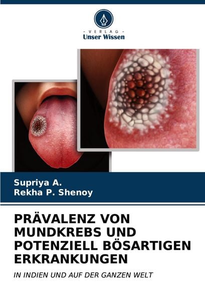 Produktbild: Pr&auml;valenz von Mundkrebs und Potenziell B&ouml;sartigen Erkrankungen