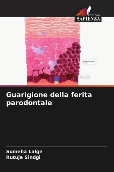 Produktbild: Guarigione della ferita parodontale