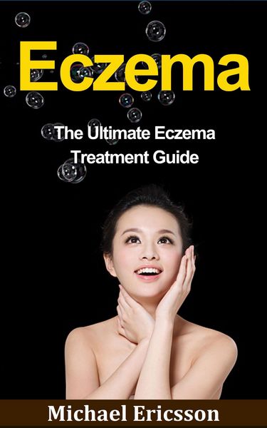 Produktbild: Eczema: The Ultimate Eczema Treatment Guide