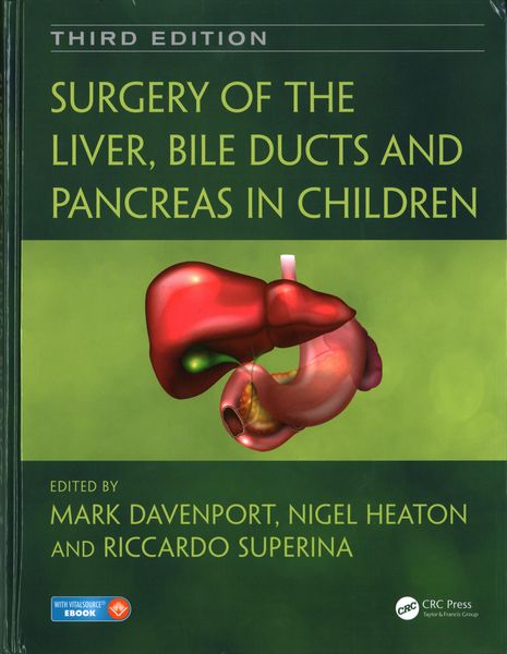 Produktbild: Surgery of the Liver, Bile Ducts and Pancreas in Children