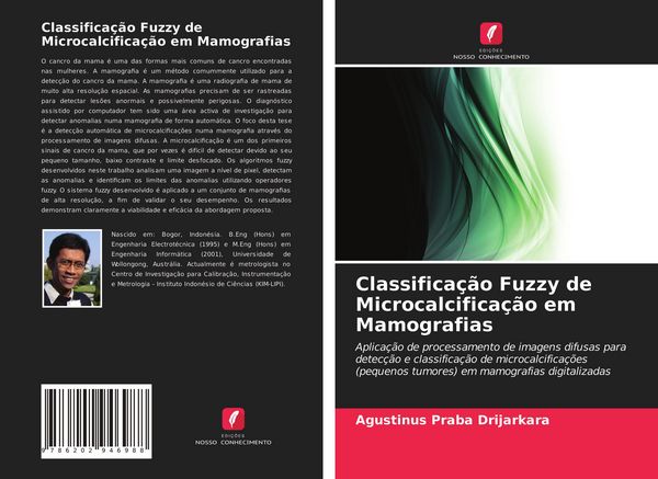 Produktbild: Classifica&ccedil;&atilde;o Fuzzy de Microcalcifica&ccedil;&atilde;o em Mamografias