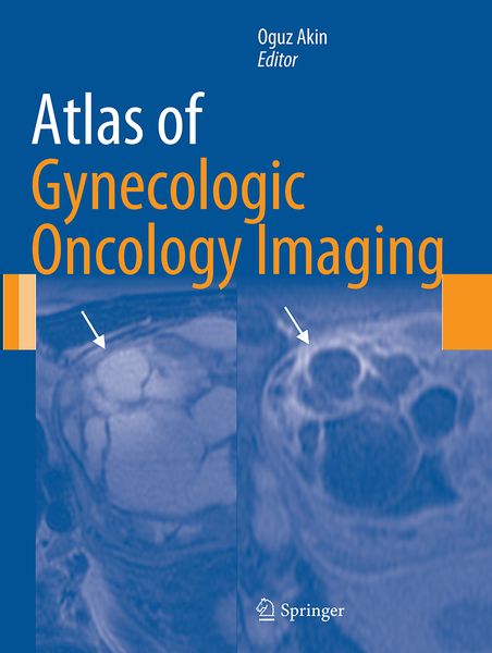Produktbild: Atlas of Gynecologic Oncology Imaging