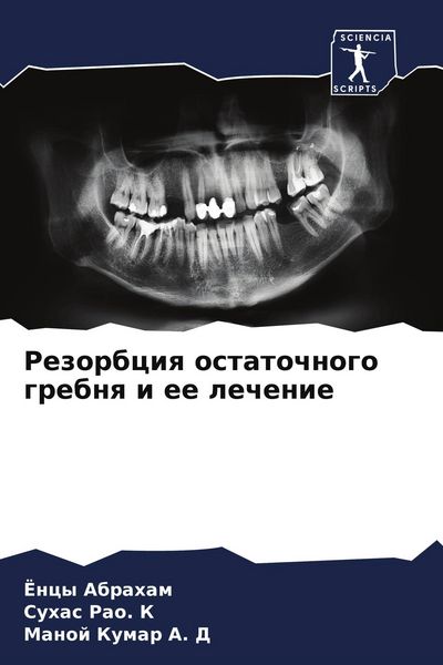 Produktbild: Rezorbciq ostatochnogo grebnq i ee lechenie