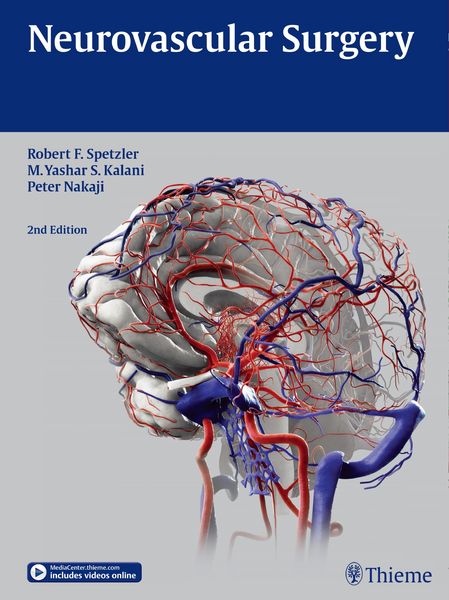 Produktbild: Neurovascular Surgery