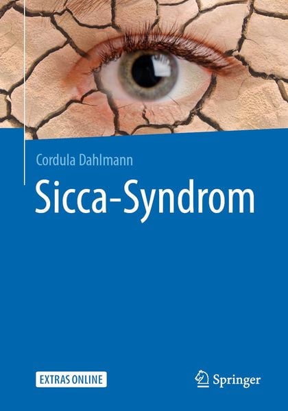 Produktbild: Sicca-Syndrom