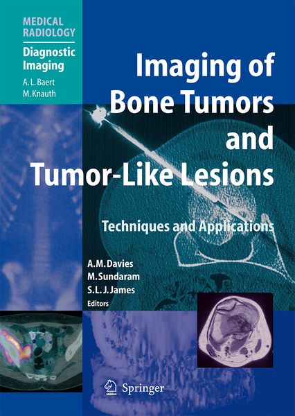 Produktbild: Imaging of Bone Tumors and Tumor-Like Lesions