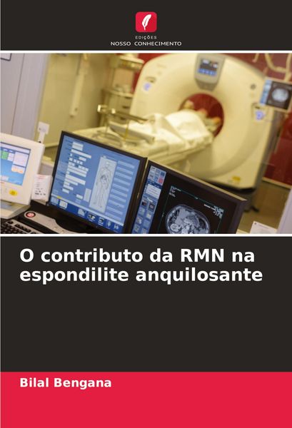 Produktbild: O contributo da RMN na espondilite anquilosante