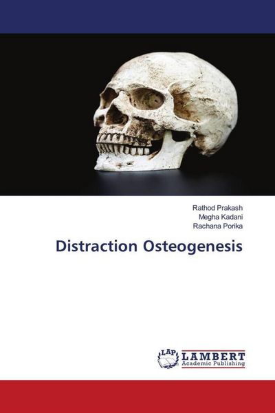 Produktbild: Distraction Osteogenesis