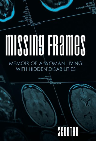 Produktbild: Missing Frames